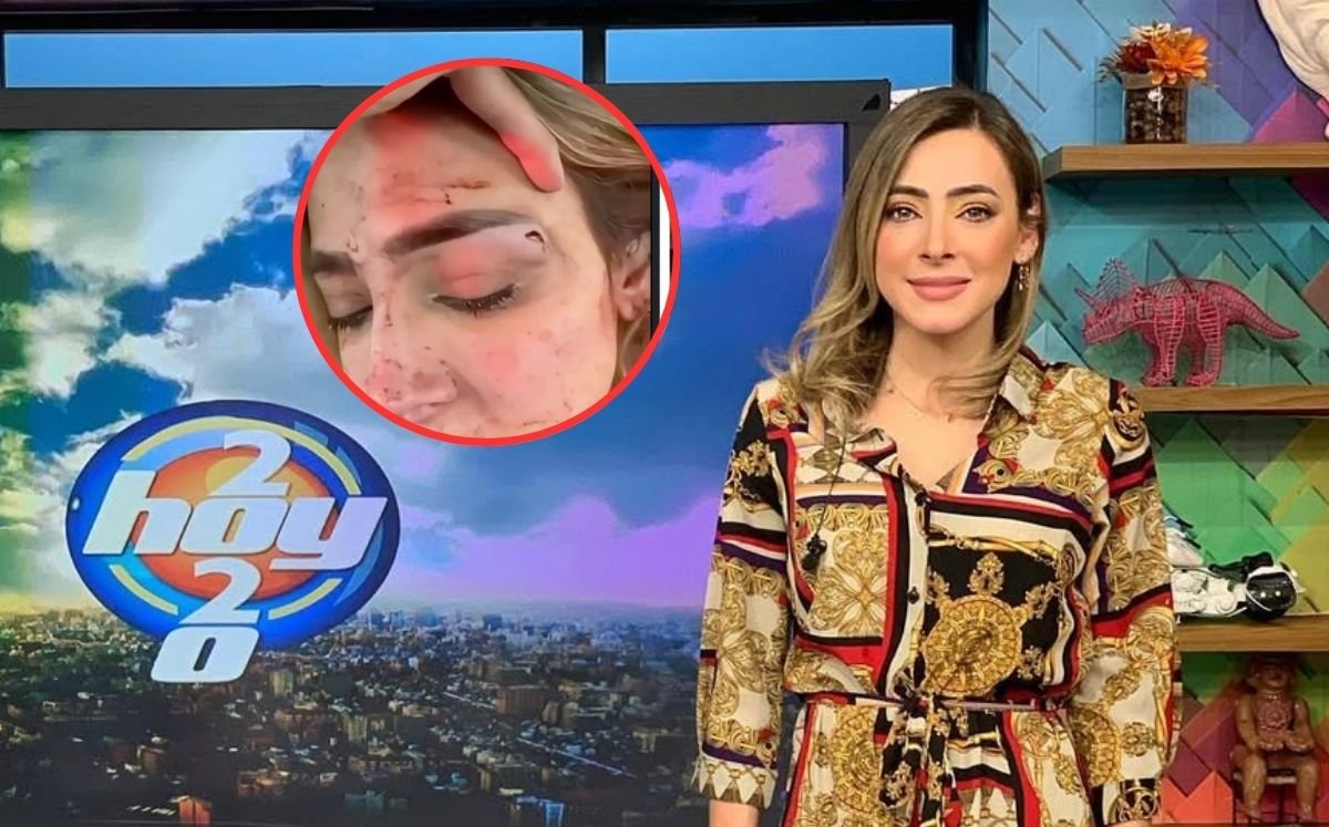 La actriz Edna Monroy hizo pública su denuncia contra su expareja, revelando pruebas impactantes que incluyen fotos y audios.